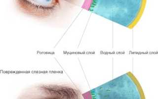 Средства офтальмологические синдром сухого глаза