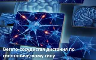 Синдром вегето сосудистой дистонии по гипотоническому типу