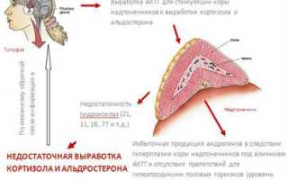 Адреногенитальный синдром у новорожденных причины