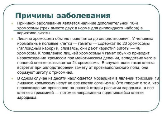 синдром эдвардса признаки