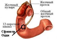 Спазм сфинктера Одди