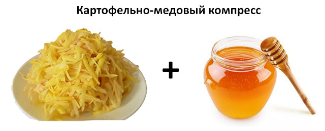 картофельно-медовый компресс