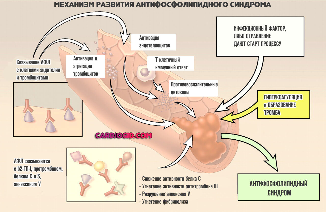 АФС
