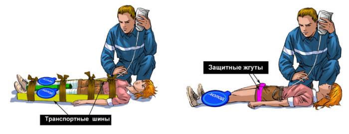 Первая помощь при синдроме длительного сдавления и его лечение