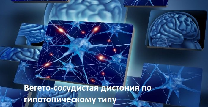 Гипотонический тип ВСД