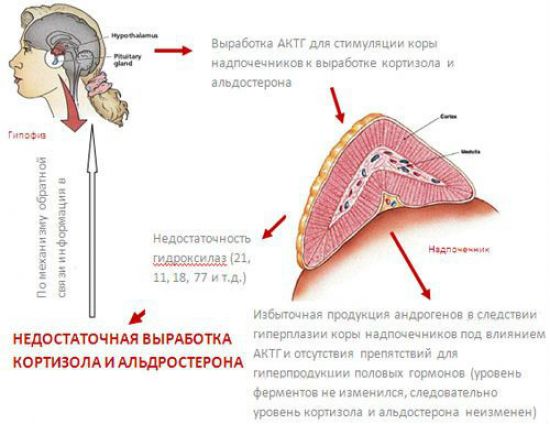 Андрогенитальный синдром