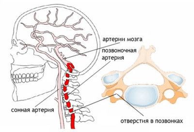 боль голова 2