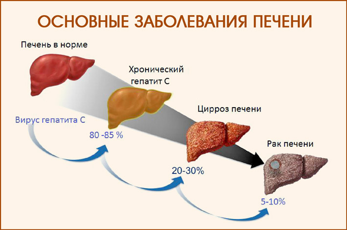 Основные болезни печени