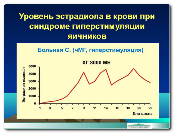 уровень эстрадиола при гиперстимуляции яичников