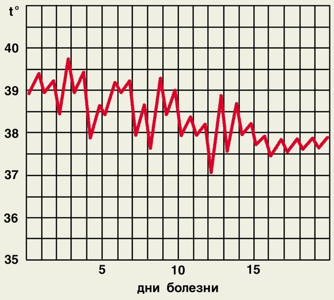 Неправильный тип температурной кривой