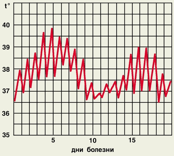 Волнообразный тип температурной кривой