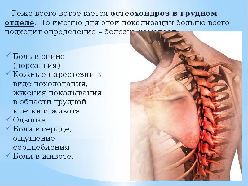 Остеохондроз шейного отдела с корешковым синдромом лечение