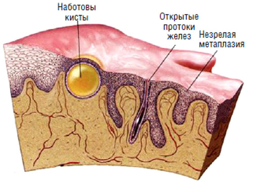 схематичное изображение