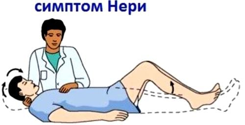 Остеохондроз шейного отдела с корешковым синдромом лечение