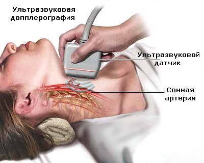 Ультразвуковая допплерография