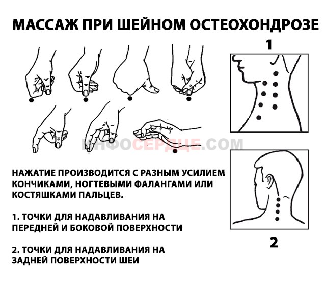 Массаж при шейном остеохондрозе