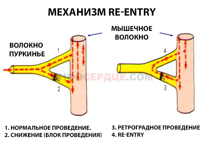 механизм re-entry