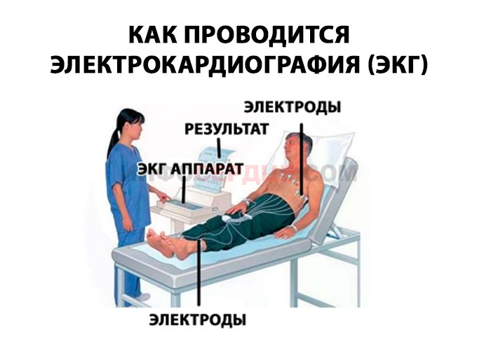 Электрокардиография