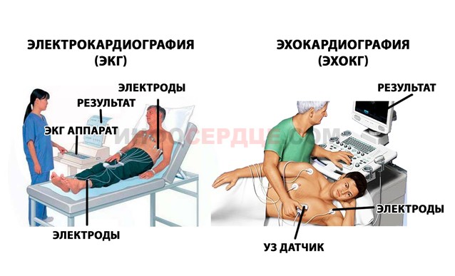 как проводится ЭКГ и ЭХОКГ