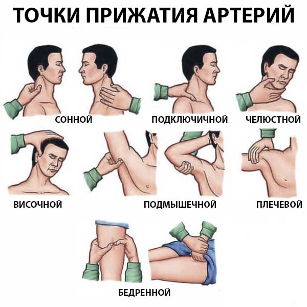 Места прижатия