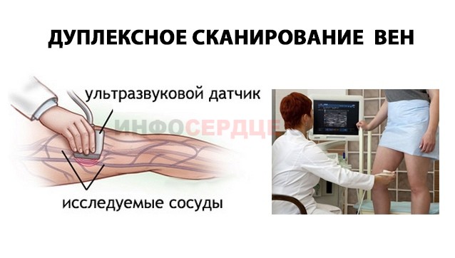 Дуплексное сканирование